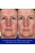 Hydrogel Face Mask (6 Pack)