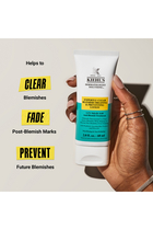 Full Face Acne Treatment Lotion
