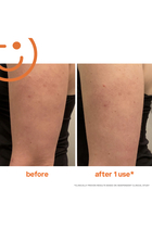 ExfoliKate™ Resurfacing Body Scrub