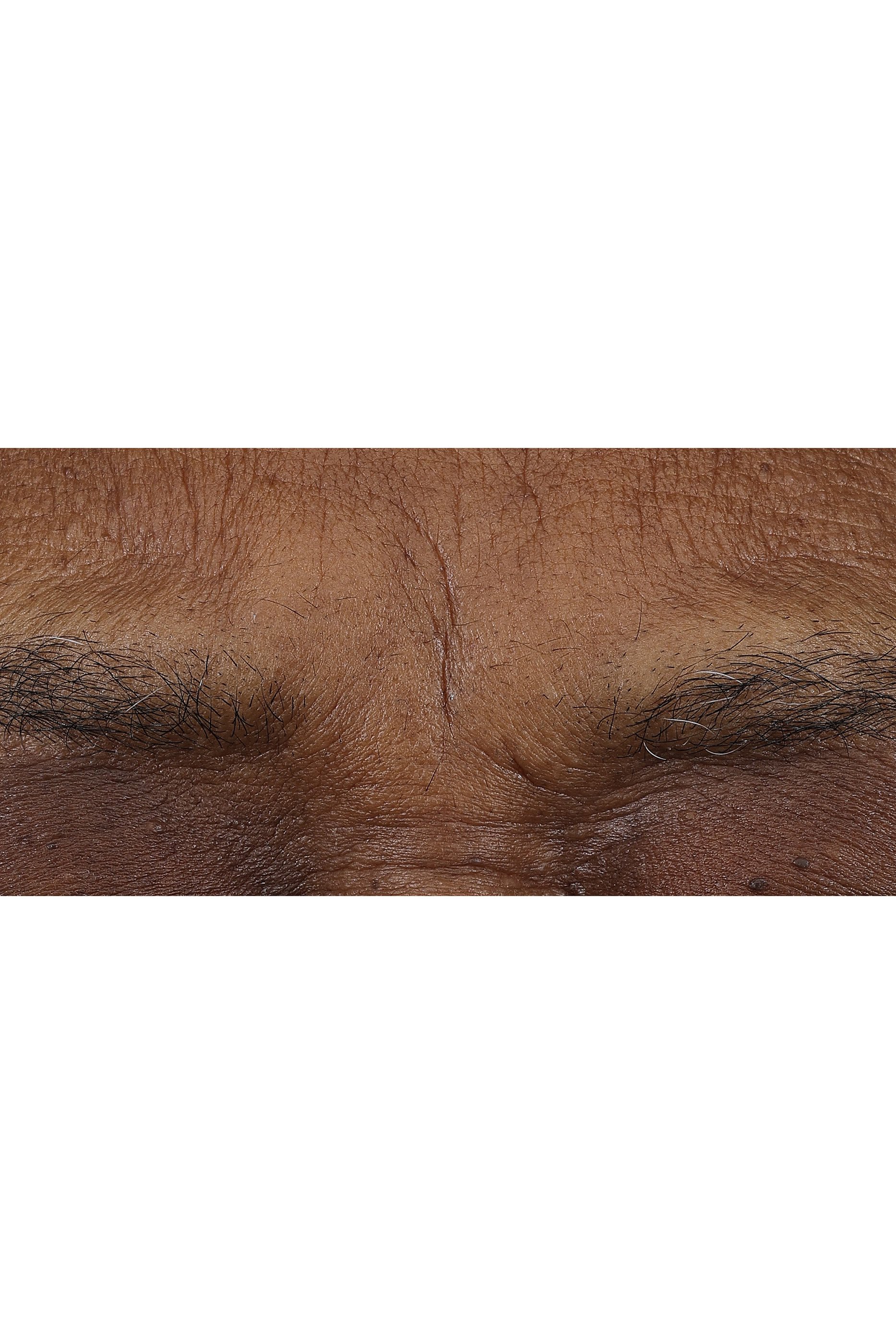 Smart Clinical Repair&trade; AM/PM Retinoid Balm