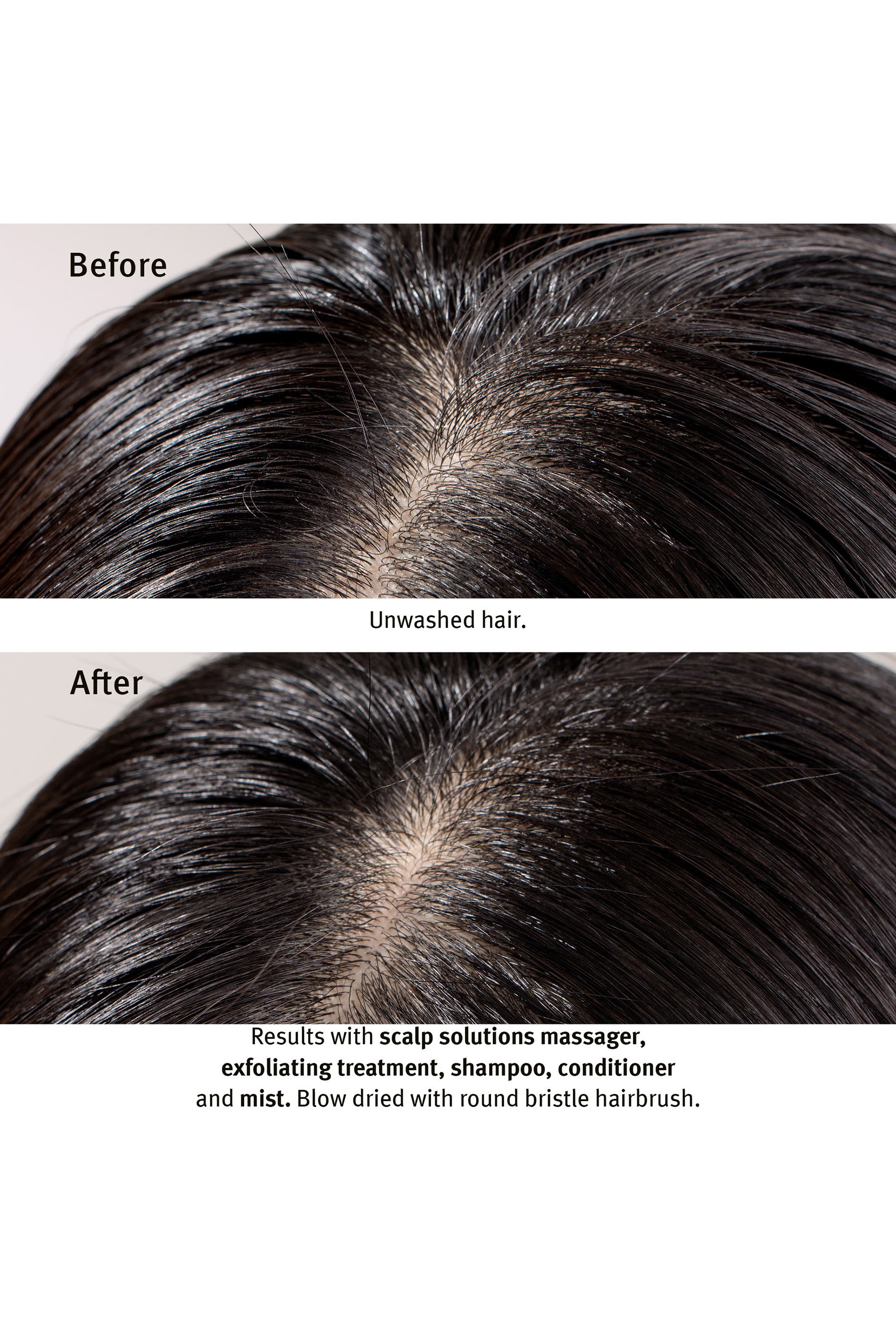 Scalp Solutions Balancing Shampoo