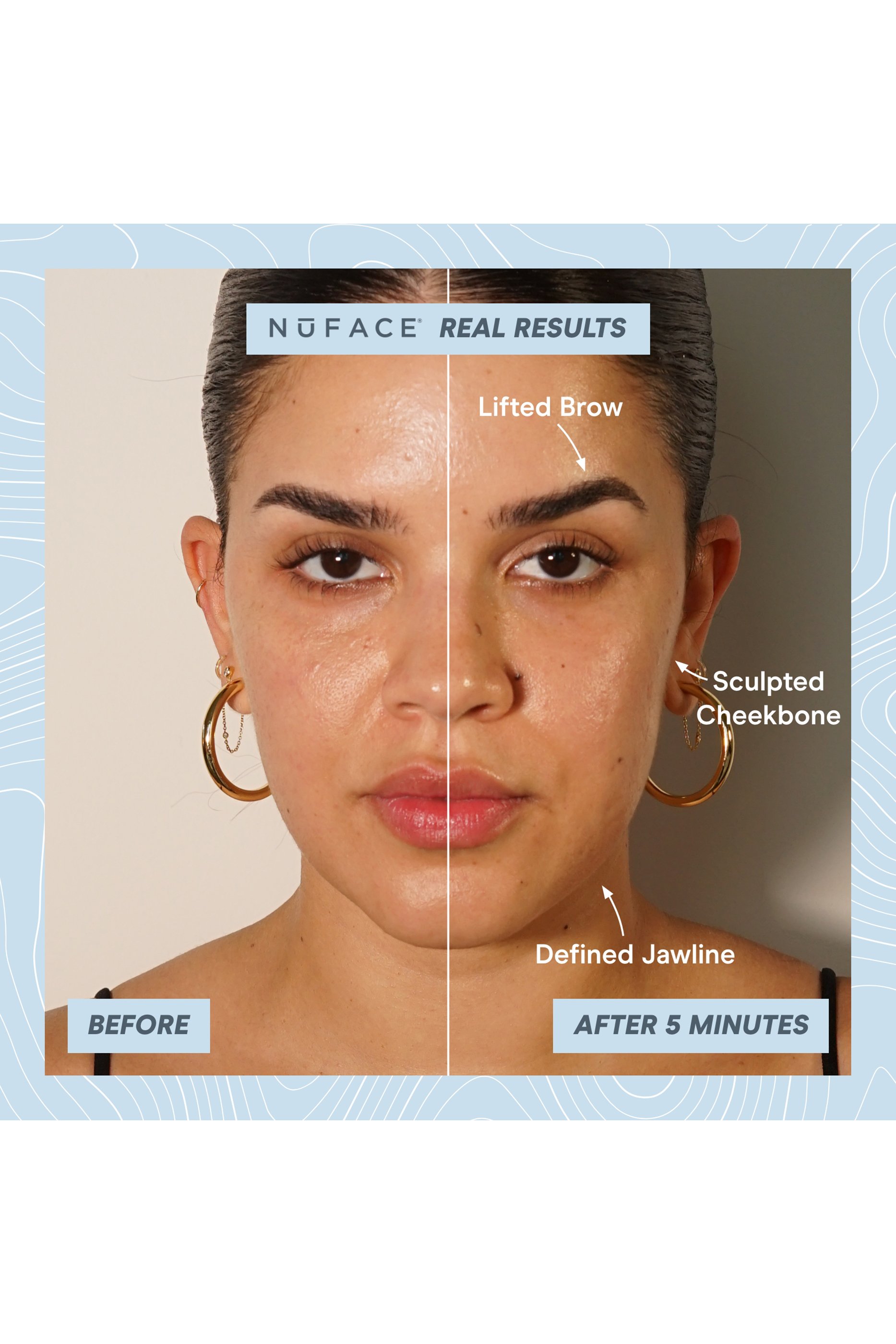 TRINITY + PRO Starter Kit